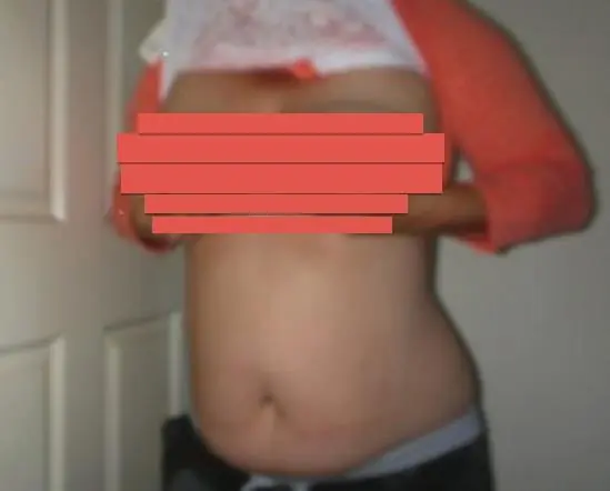 Meline image 1